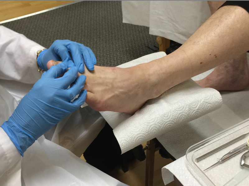 Basic and Advanced Nursing Footcare Certificate